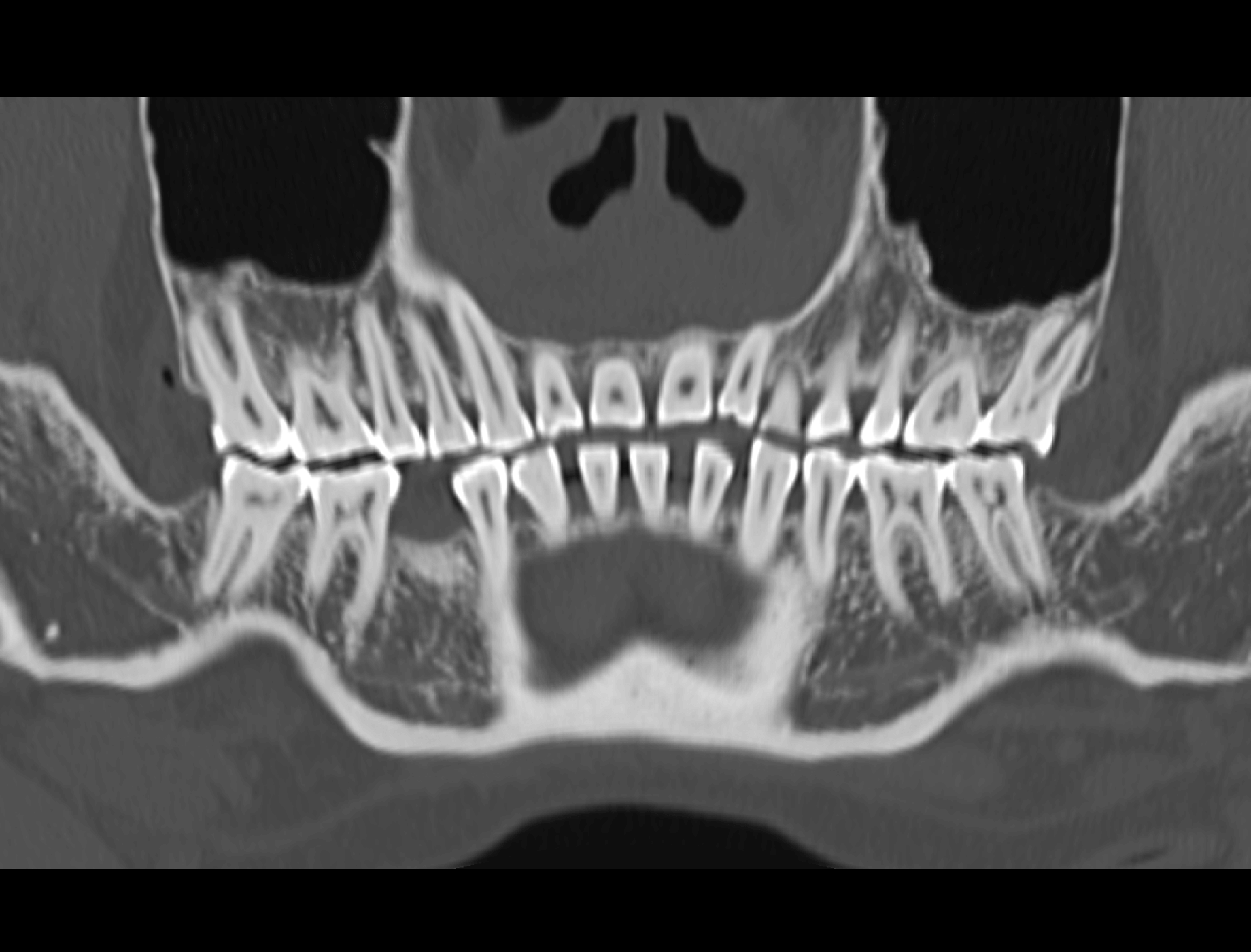 software_clinic_teeth