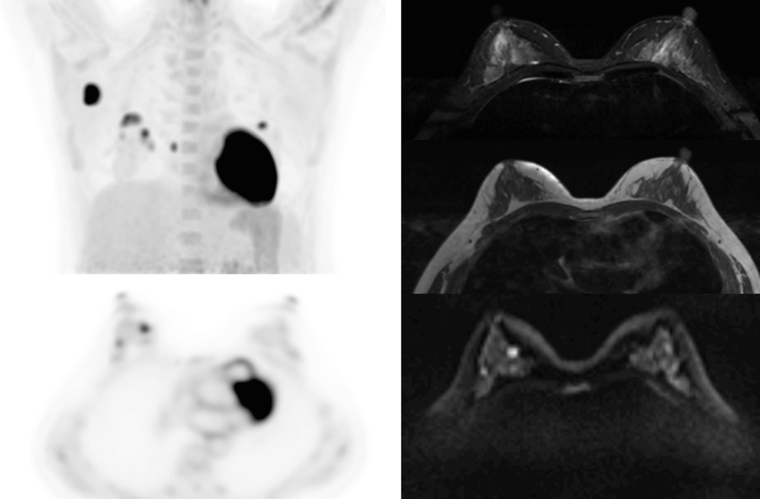 Stages of Life under Super Wide Angle