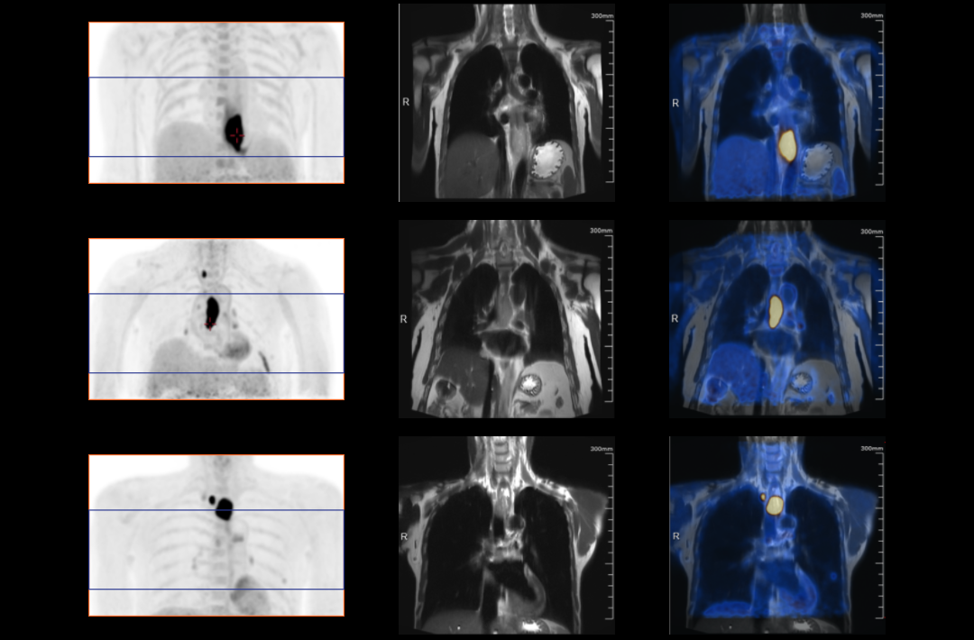 Stages of Life under Super Wide Angle