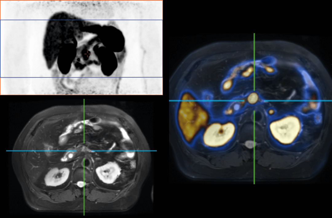 Stages of Life under Super Wide Angle