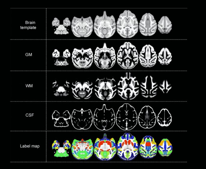Mapping the Brains of Expensive Macaques