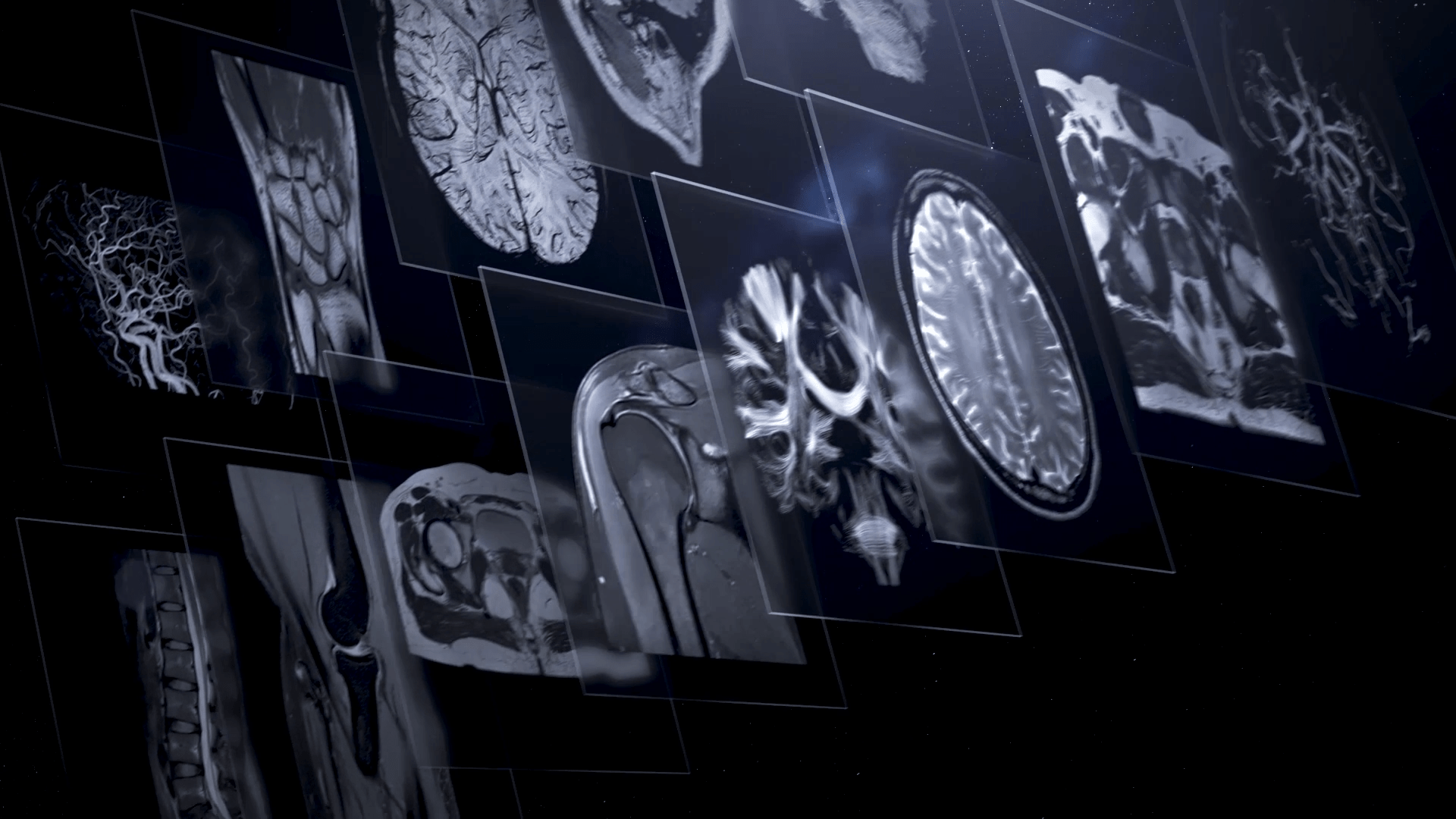 Accurately Capture the Lesions of Prostate Cancer