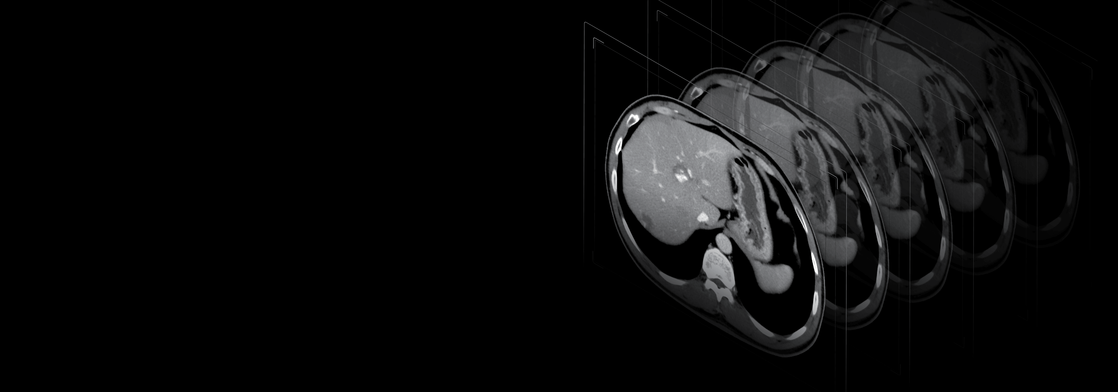 Algorytm iteracyjnej redukcji szumów KARL 3D