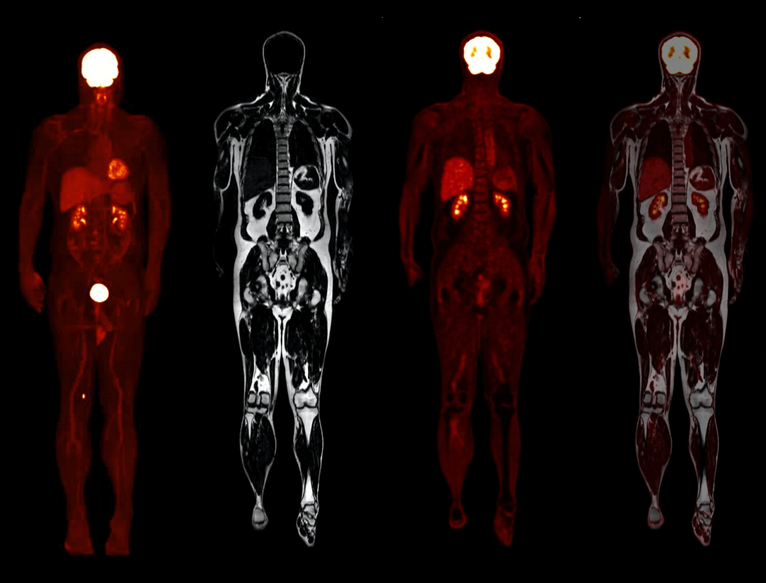 Whole-body Imaging with 4 bodies comparison