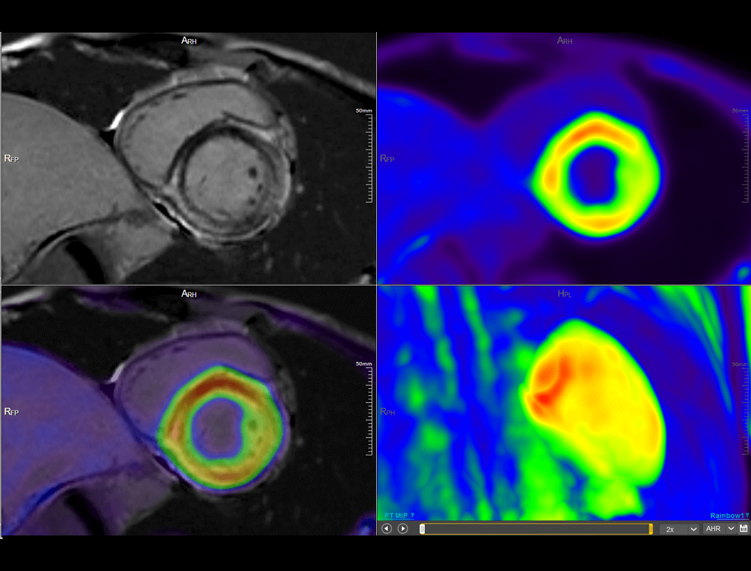 Cardiac Imaging