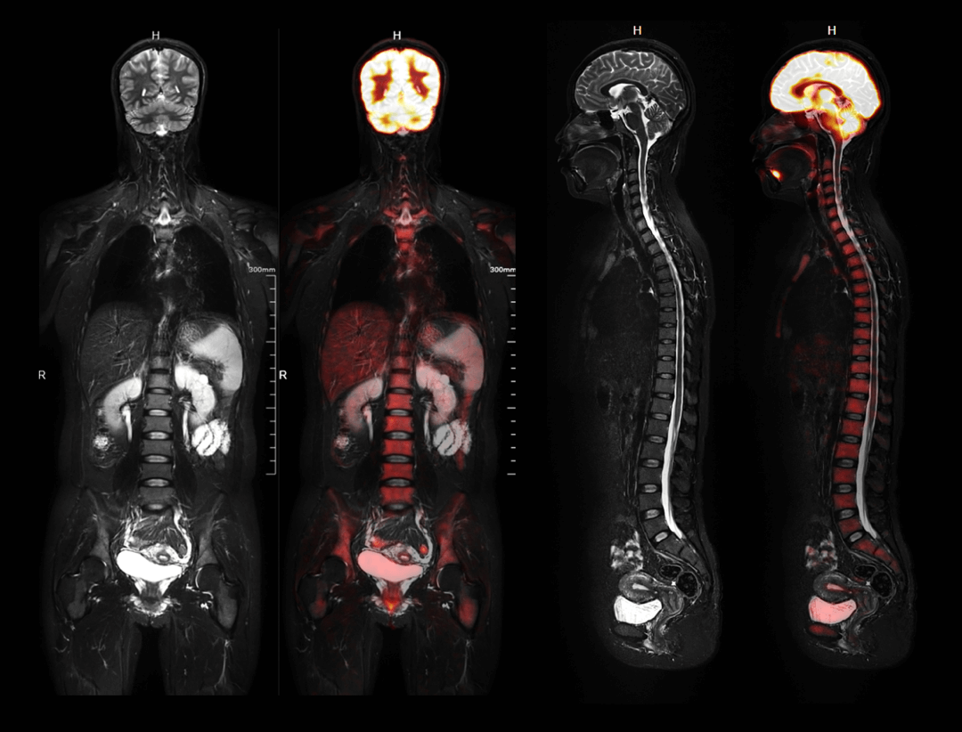 Oncology Imaging