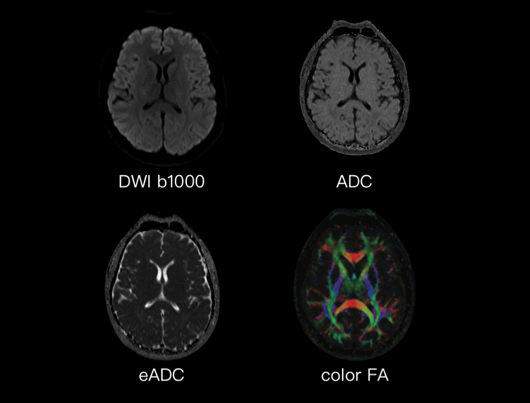 Multi-parameter Neuro Imaging