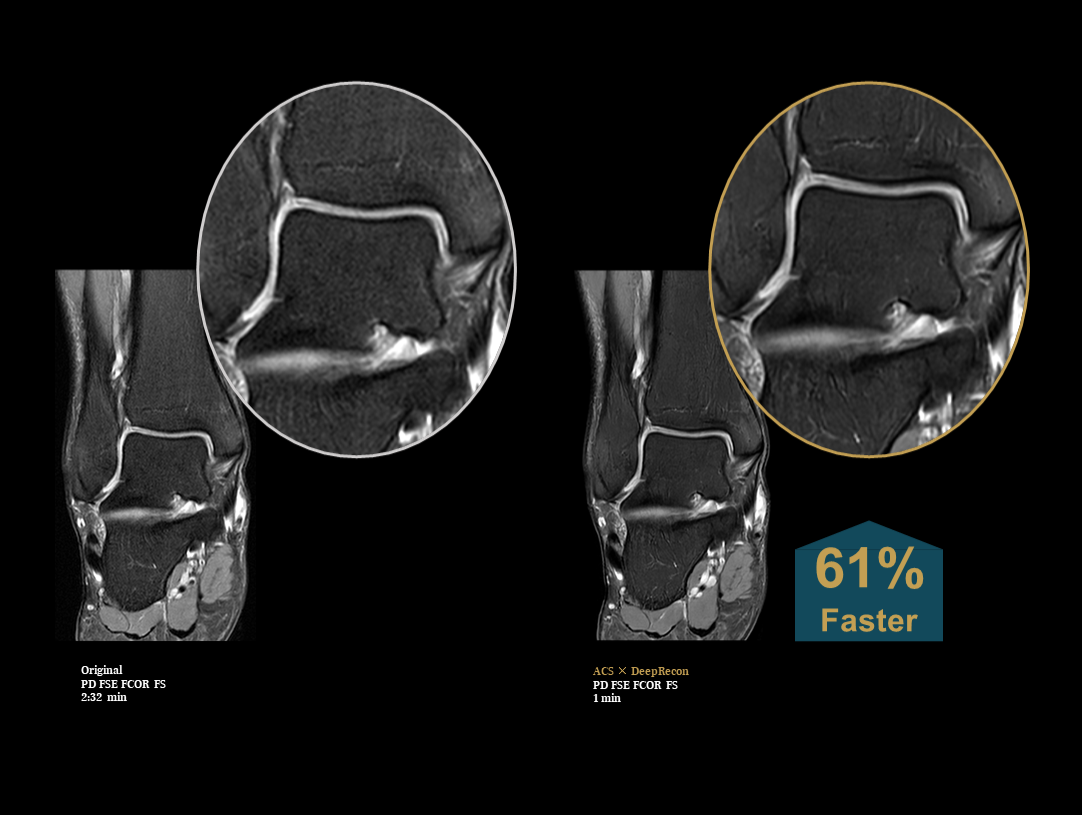 Body and lower extremity arteries CE-MRA 