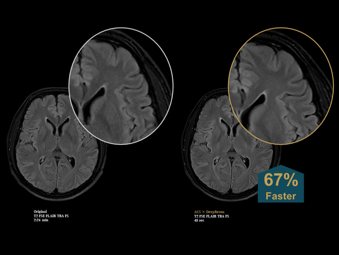 Body and lower extremity arteries CE-MRA 
