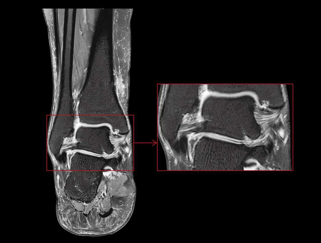 Obrazowanie kostki z powiększeniem szczegółów