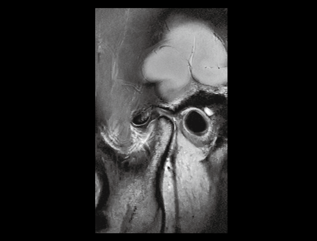 Obrazowanie stawu skroniowo-żuchwowego